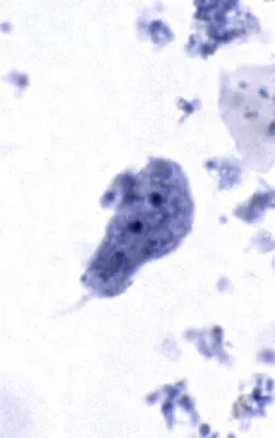  Dientamoeba Fragilis:  A Tiny Troublemaker That Can Cause Unexpected Stomach Rumbles!