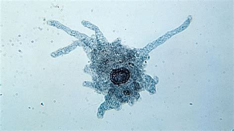  Unscultured Unicellular Amoeba: Is This Microscopic Marvel a Living Blob or a Tiny Alien?!